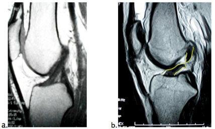 Knee conditions