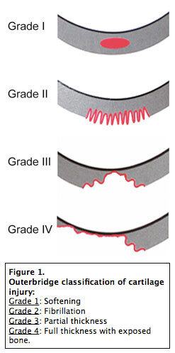 Articular cartilage fig1