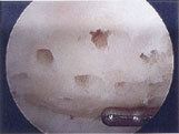 Articular cartilage fig2