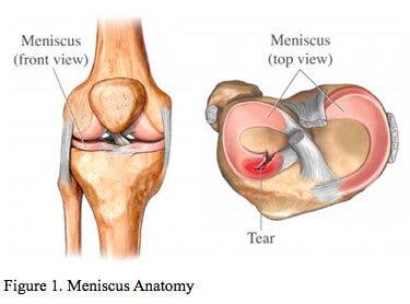 Torn meniscus pain clearance at night
