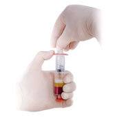 prp 1