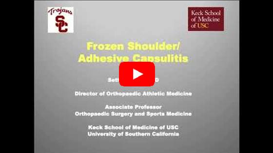 Frozen Shoulder (Adhesive Capsulitis) Lecture and Arthroscopic Capsular Release. Gamradtortho.com